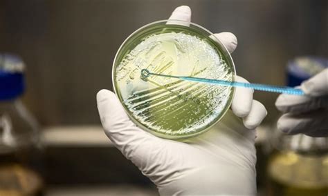 Alternative Antibiotika Bakteriophagen Therapie Düren Viren Multiresistente Keime MRSA Arzt Naturheilpraxis 